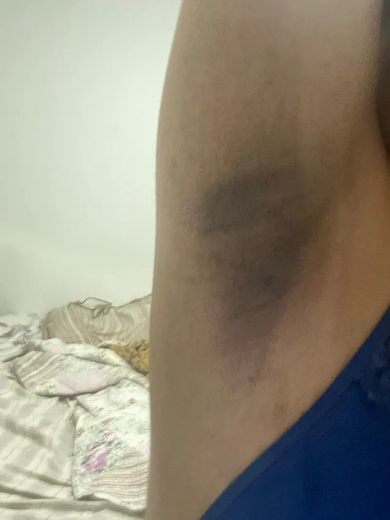 Axila antes do uso
